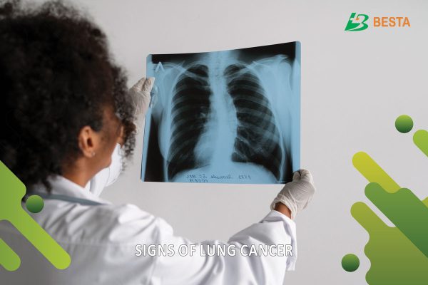 7 Key Signs of Lung Cancer Everyone Should Know