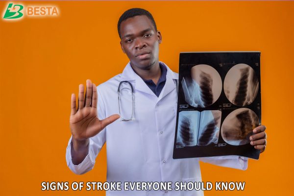 Stroke Warning Signs: 7 Warning Signs of Stroke Everyone Should Know