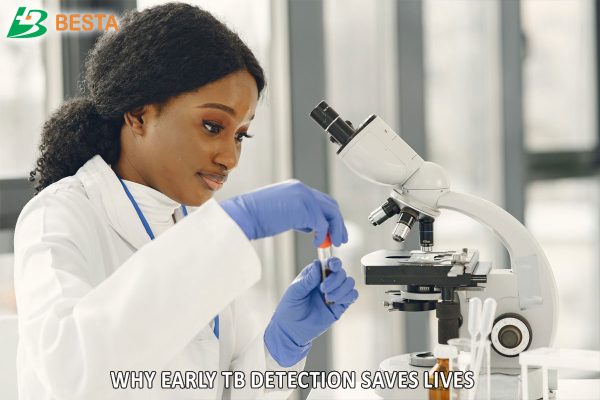Why Early TB Detection Saves Lives: 5 Critical Reasons to Get Tested