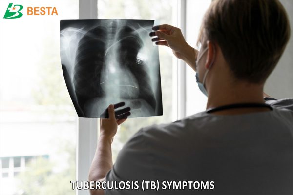 Tuberculosis Symptoms: 6 Silent Signs You Should Watch For