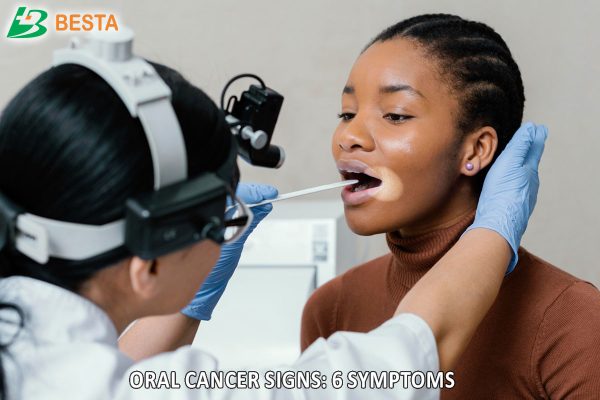 Oral Cancer Signs: 6 Symptoms You Should Never Ignore