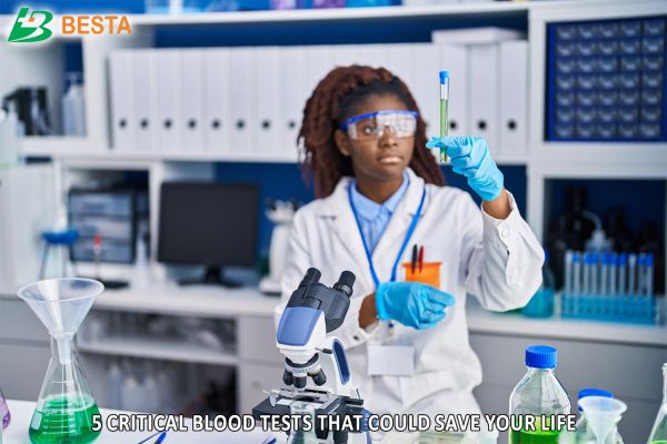 Laboratory Services: 5 Critical Blood Tests That Could Save Your Life
